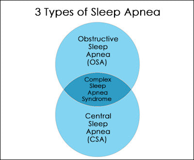 Three Types of Sleep Apnea