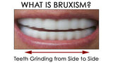 What is Bruxism and Is It Bad For My Teeth?