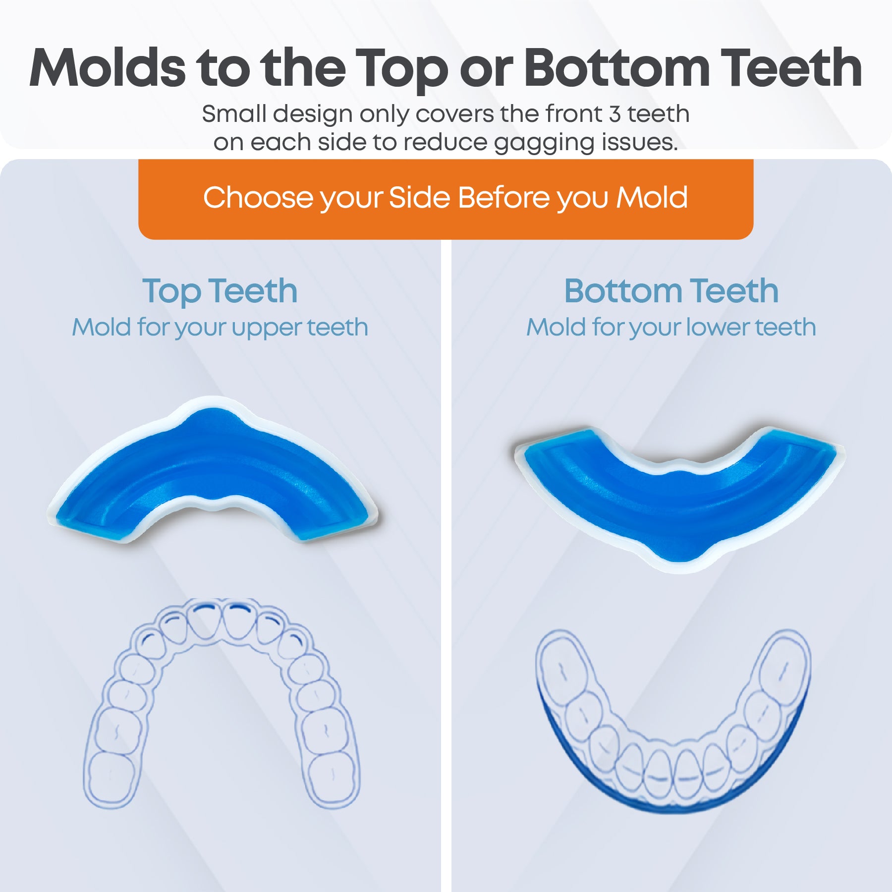 Brux Night Guard molded for either top or bottom teeth, covering the front three teeth on each side